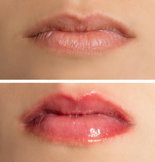 SPICY GLOSS - EXTRA VOLUME 7 ML